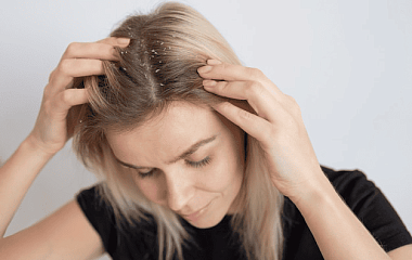 Как отличить перхоть от псориаза