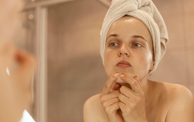 Как избавиться от постакне на лице