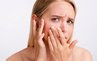 Атопический дерматит на лице